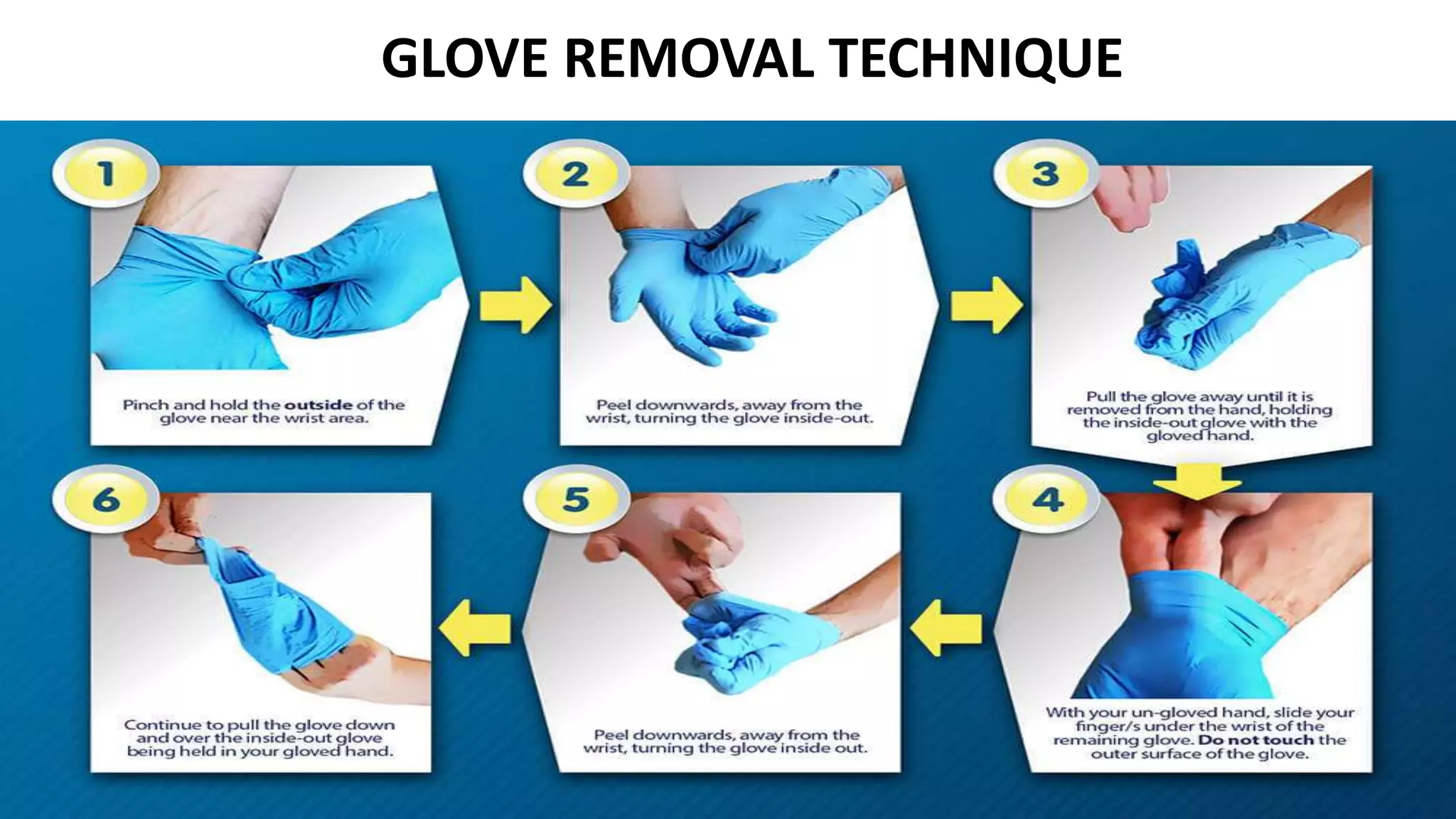 GLOVE REMOVAL TECHNIQUE
 