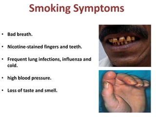 Smoking Symptoms

• Bad breath.

• Nicotine-stained fingers and teeth.

• Frequent lung infections, influenza and
  cold.

• high blood pressure.

• Loss of taste and smell.
 