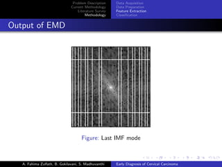 Cervical cancer diagnosis under machine learning | PDF