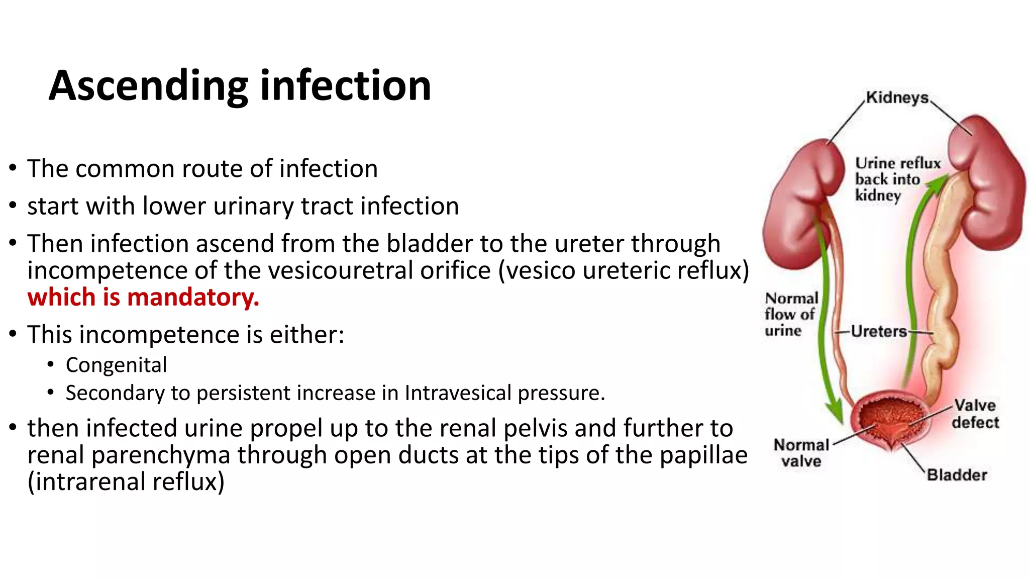 Ascending infection
• The common route of infection
• start with lower urinary tract infection
• Then infection ascend from the bladder to the ureter through
incompetence of the vesicouretral orifice (vesico ureteric reflux)
which is mandatory.
• This incompetence is either:
• Congenital
• Secondary to persistent increase in Intravesical pressure.
• then infected urine propel up to the renal pelvis and further to
renal parenchyma through open ducts at the tips of the papillae
(intrarenal reflux)
 