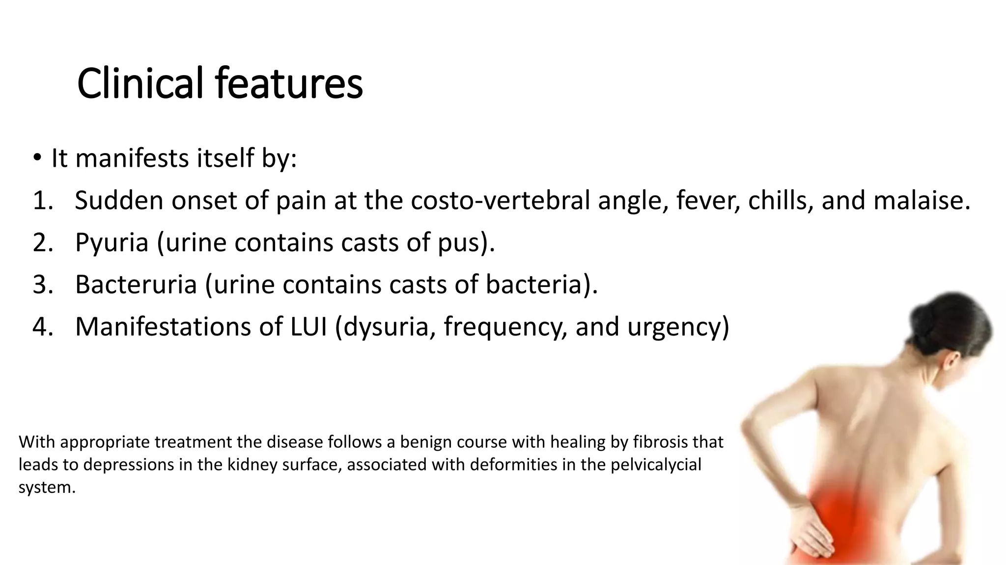 Clinical features
• It manifests itself by:
1. Sudden onset of pain at the costo-vertebral angle, fever, chills, and malaise.
2. Pyuria (urine contains casts of pus).
3. Bacteruria (urine contains casts of bacteria).
4. Manifestations of LUI (dysuria, frequency, and urgency)
With appropriate treatment the disease follows a benign course with healing by fibrosis that
leads to depressions in the kidney surface, associated with deformities in the pelvicalycial
system.
 