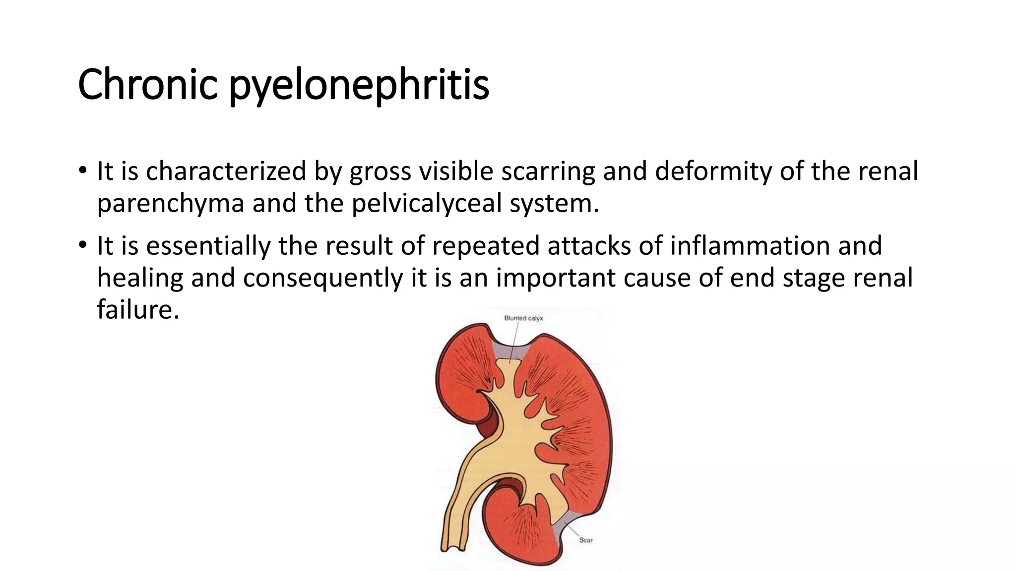 Chronic pyelonephritis
• It is characterized by gross visible scarring and deformity of the renal
parenchyma and the pelvicalyceal system.
• It is essentially the result of repeated attacks of inflammation and
healing and consequently it is an important cause of end stage renal
failure.
 