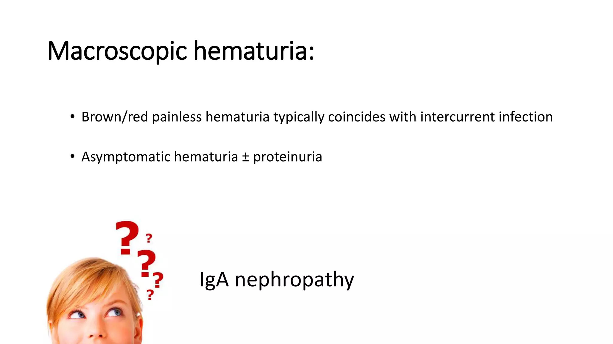 Macroscopic hematuria:
• Brown/red painless hematuria typically coincides with intercurrent infection
• Asymptomatic hematuria ± proteinuria
IgA nephropathy
 