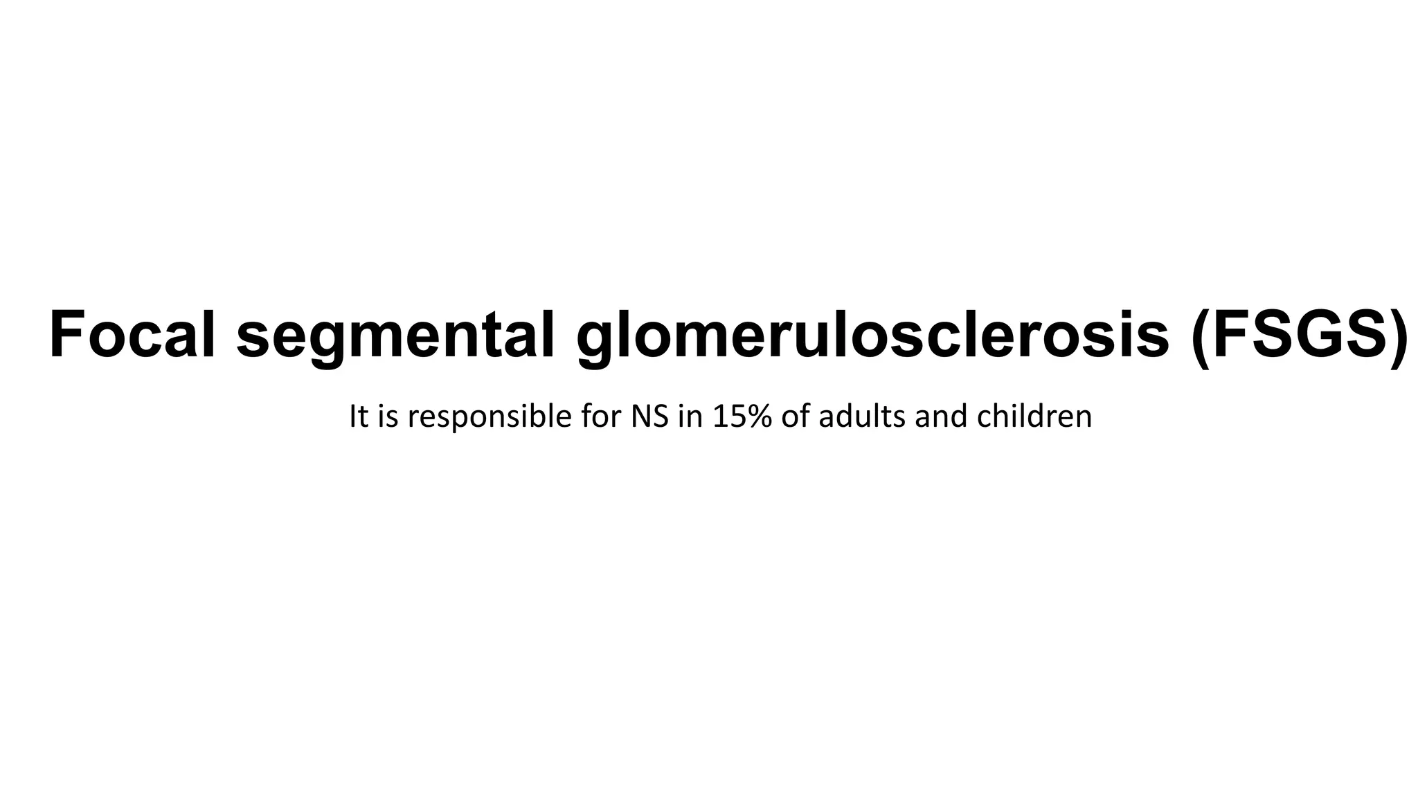 Focal segmental glomerulosclerosis (FSGS)
It is responsible for NS in 15% of adults and children
 