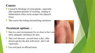 Skin Sweating Disorders Problem structure of skin and problem associated with skin | PPTX