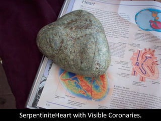 SerpentiniteHeart with Visible Coronaries.<br />