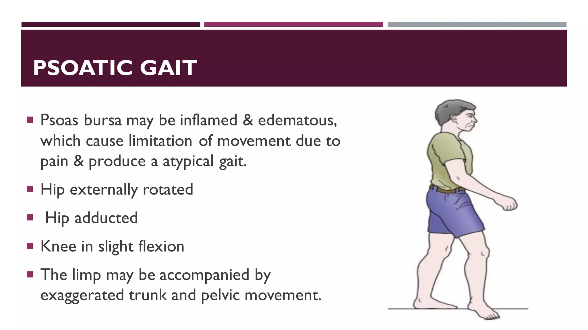 PSOATIC GAIT
 Psoas bursa may be inflamed & edematous,
which cause limitation of movement due to
pain & produce a atypical gait.
 Hip externally rotated
 Hip adducted
 Knee in slight flexion
 The limp may be accompanied by
exaggerated trunk and pelvic movement.
 