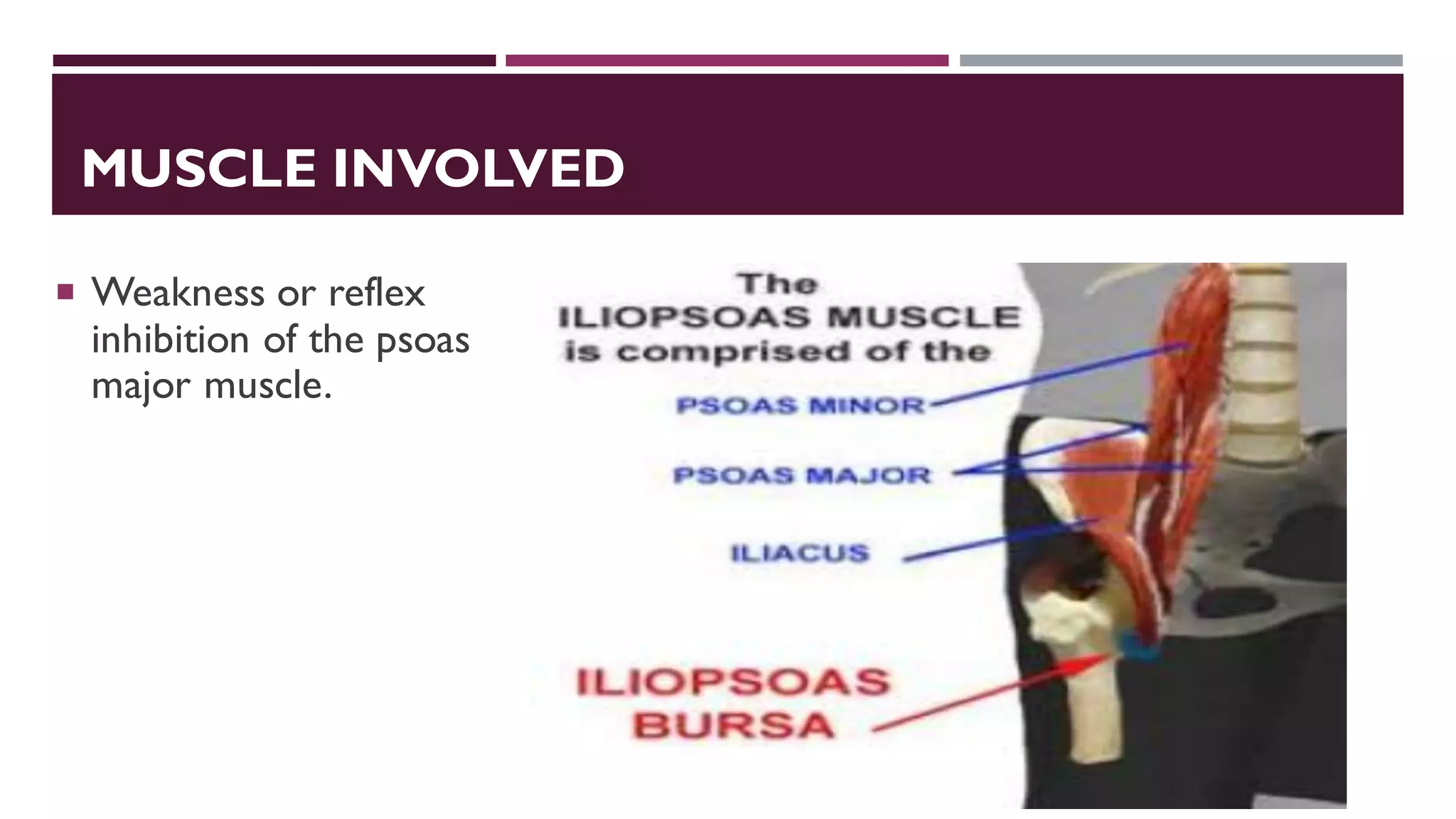 MUSCLE INVOLVED
 Weakness or reflex
inhibition of the psoas
major muscle.
 