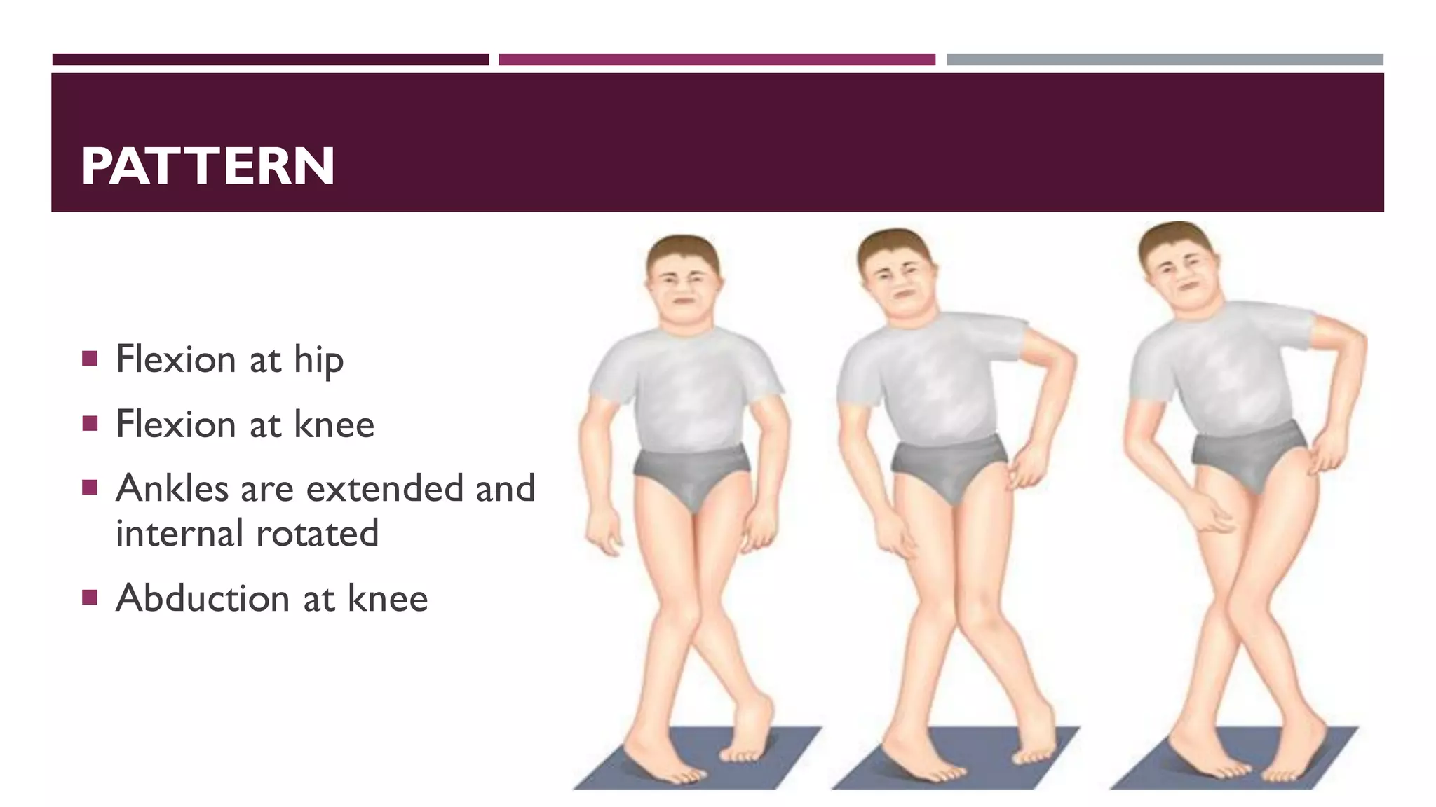 PATTERN
 Flexion at hip
 Flexion at knee
 Ankles are extended and
internal rotated
 Abduction at knee
 