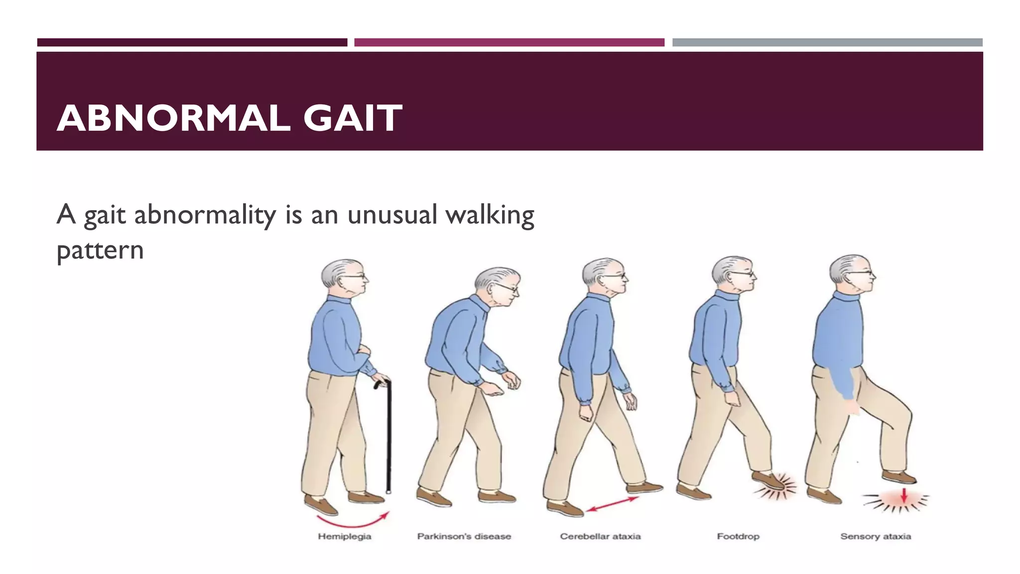 ABNORMAL GAIT
A gait abnormality is an unusual walking
pattern
 