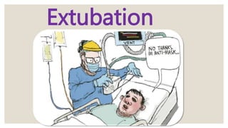 Extubation
 