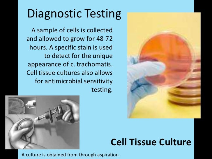 Chlamydia Class Presentation