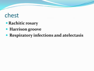 chest
 Rachitic rosary
 Harrison groove
 Respiratory infections and atelectasis
 