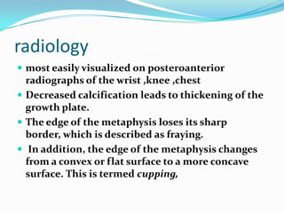 radiology
 most easily visualized on posteroanterior
  radiographs of the wrist ,knee ,chest
 Decreased calcification leads to thickening of the
  growth plate.
 The edge of the metaphysis loses its sharp
  border, which is described as fraying.
 In addition, the edge of the metaphysis changes
  from a convex or flat surface to a more concave
  surface. This is termed cupping,
 