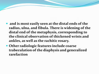  and is most easily seen at the distal ends of the
  radius, ulna, and fibula. There is widening of the
  distal end of the metaphysis, corresponding to
  the clinical observation of thickened wrists and
  ankles, as well as the rachitic rosary.
 Other radiologic features include coarse
  trabeculation of the diaphysis and generalized
  rarefaction
 