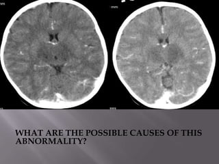 WHAT ARE THE POSSIBLE CAUSES OF THIS
ABNORMALITY?
 