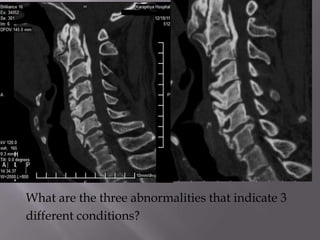 What are the three abnormalities that indicate 3
different conditions?
 
