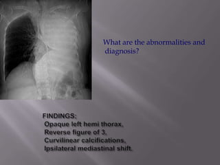 What are the abnormalities and
diagnosis?
 