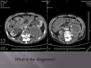What is the diagnosis?
 