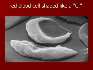red blood cell shaped like a "C."