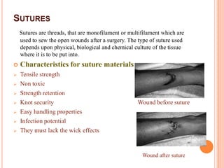 SUTURES
    Sutures are threads, that are monofilament or multifilament which are
    used to sew the open wounds after a surgery. The type of suture used
    depends upon physical, biological and chemical culture of the tissue
    where it is to be put into.
   Characteristics for suture materials
   Tensile strength
   Non toxic
   Strength retention
   Knot security                                    Wound before suture
   Easy handling properties
   Infection potential
   They must lack the wick effects


                                                       Wound after suture
 