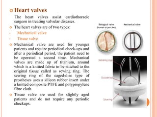  Heart valves
  The heart valves assist cardiothoracic
  surgeon in treating valvular diseases.
 The heart valves are of two types:
•   Mechanical valve
•   Tissue valve
 Mechanical valve are used for younger
  patients and require periodical check-ups and
  after a periodical period, the patient need to
  be operated a second time. Mechanical
  valves are made up of titanium, around
  which is a knitted fabric to be stitched to the
  original tissue called as sewing ring. The
  sewing ring of the caged-disc type of
  prostheses uses a silicon rubber insert under
  a knitted composite PTFE and polypropylene
  fibre cloth.
 Tissue valve are used for slightly aged
  patients and do not require any periodic
  checkups.
 