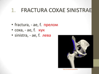 1. FRACTURA COXAE SINISTRAE
• fractura, - ae, f. прелом
• coxa, - ae, f. кук
• sinistra, - ae, f. лева
http://en.wikipedia.org/wiki/Hip
 