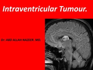Intraventricular Tumour.

Dr: ABD ALLAH NAZEER. MD.

 