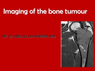 Imaging of the bone tumour

BY. Dr. ABD ALLAH NAZEER. MD.

 