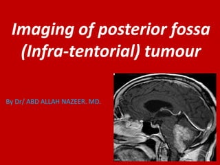 Imaging of posterior fossa
(Infra-tentorial) tumour
By Dr/ ABD ALLAH NAZEER. MD.

 