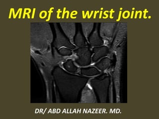 MRI of the wrist joint.
DR/ ABD ALLAH NAZEER. MD.
 