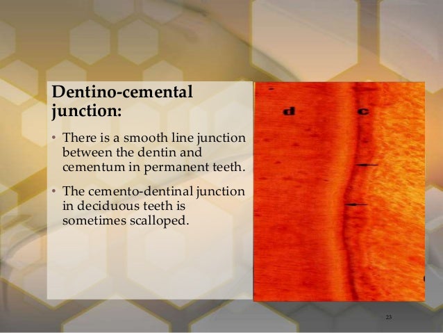 DENTIN DENTIN