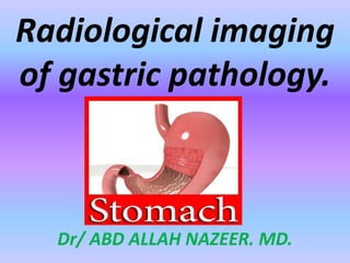 Dr/ ABD ALLAH NAZEER. MD.
Radiological imaging
of gastric pathology.
 