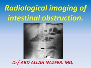 Radiological imaging of
intestinal obstruction.
Dr/ ABD ALLAH NAZEER. MD.
 