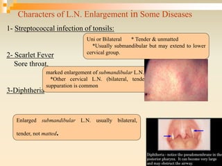 Characters of L.N. Enlargement in Some Diseases
1- Streptococcal infection of tonsils:
2- Scarlet Fever
Sore throat.
3-Diphtheria
Uni or Bilateral * Tender & unmatted
*Usually submandibular but may extend to lower
cervical group.
marked enlargement of submandibular L.N.
*Other cervical L.N. (bilateral, tender, discrete,
suppuration is common
Enlarged submandibular L.N. usually bilateral,
tender, not matted.
 