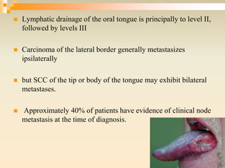  Lymphatic drainage of the oral tongue is principally to level II,
followed by levels III
 Carcinoma of the lateral border generally metastasizes
ipsilaterally
 but SCC of the tip or body of the tongue may exhibit bilateral
metastases.
 Approximately 40% of patients have evidence of clinical node
metastasis at the time of diagnosis.
 
