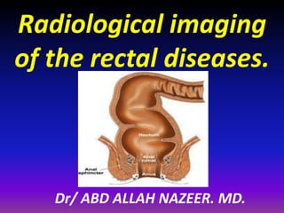 Dr/ ABD ALLAH NAZEER. MD.
Radiological imaging
of the rectal diseases.
 