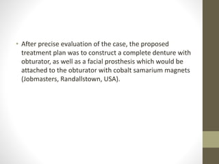 • After precise evaluation of the case, the proposed 
treatment plan was to construct a complete denture with 
obturator, as well as a facial prosthesis which would be 
attached to the obturator with cobalt samarium magnets 
(Jobmasters, Randallstown, USA). 
 