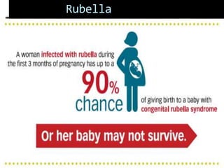 Rubella
 