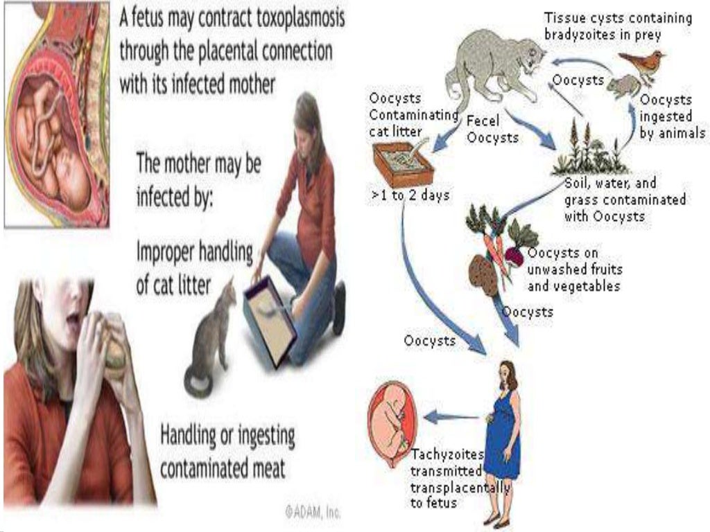 TORCH INFECTIONS