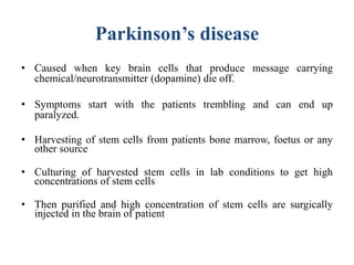 Parkinson’s disease
• Caused when key brain cells that produce message carrying
chemical/neurotransmitter (dopamine) die off.
• Symptoms start with the patients trembling and can end up
paralyzed.
• Harvesting of stem cells from patients bone marrow, foetus or any
other source
• Culturing of harvested stem cells in lab conditions to get high
concentrations of stem cells
• Then purified and high concentration of stem cells are surgically
injected in the brain of patient
 