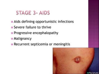  Aids defining opportunistic infections
 Severe failure to thrive
 Progressive encephalopathy
 Malignancy
 Recurrent septicemia or meningitis
 