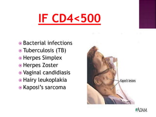  Bacterial infections
 Tuberculosis (TB)
 Herpes Simplex
 Herpes Zoster
 Vaginal candidiasis
 Hairy leukoplakia
 Kaposi’s sarcoma
 