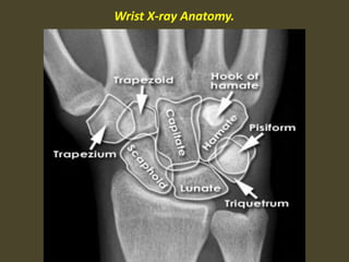 Wrist X-ray Anatomy.
 