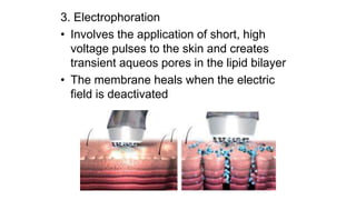 3. Electrophoration
• Involves the application of short, high
voltage pulses to the skin and creates
transient aqueos pores in the lipid bilayer
• The membrane heals when the electric
field is deactivated
 