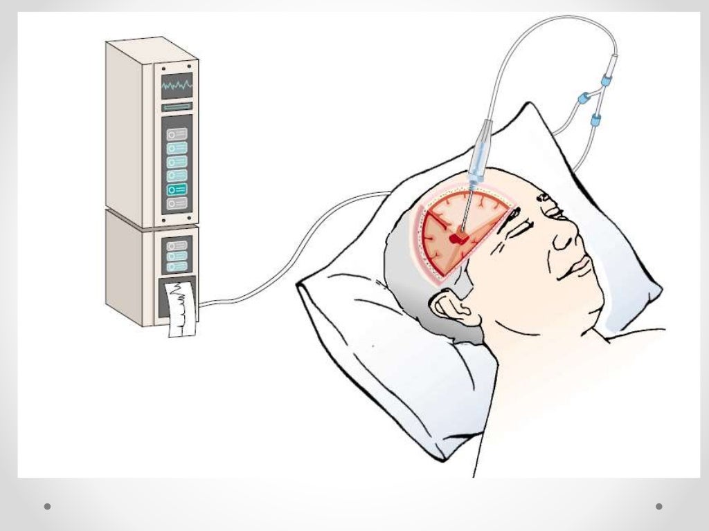 Management of patient with increased intracranial pressure