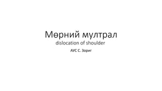 Мөрний мултрал
dislocation of shoulder
АУС С. Зориг
 