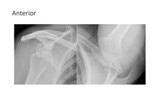 Anterior
 