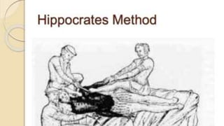 Dislocation of shoulder мөрний мултрал