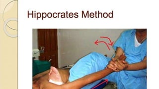 Dislocation of shoulder мөрний мултрал